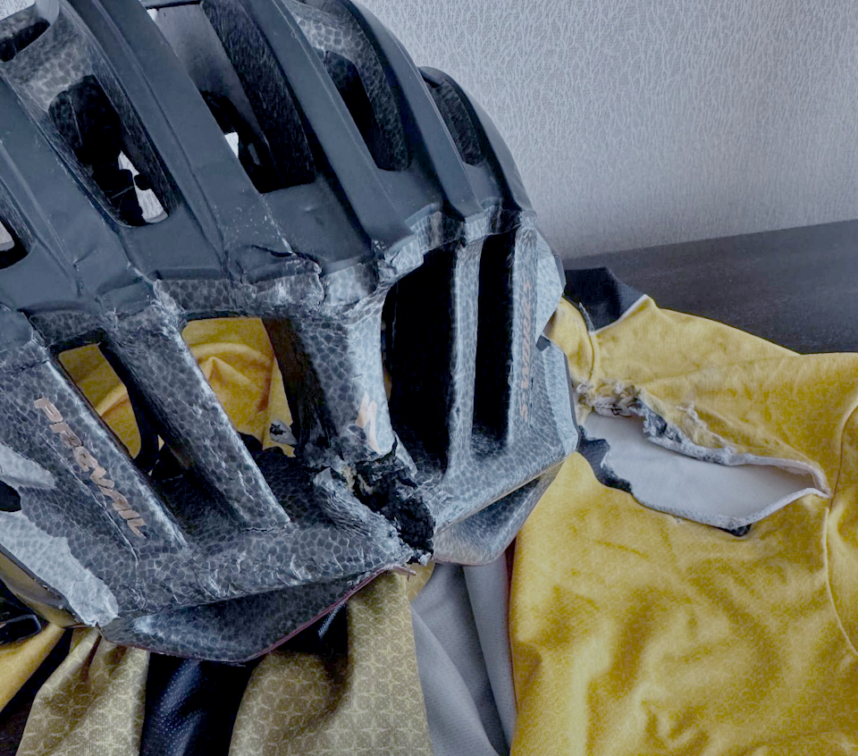 Photo: No details of the actual accident, but Ramsay's Helmet was completed cracked into nearly two pieces at the back after the impact. 