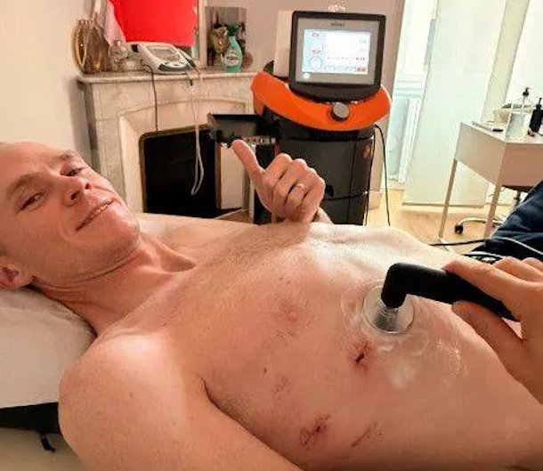Chris Froome starts Rehabilitation after Horrific near Death Training Crash