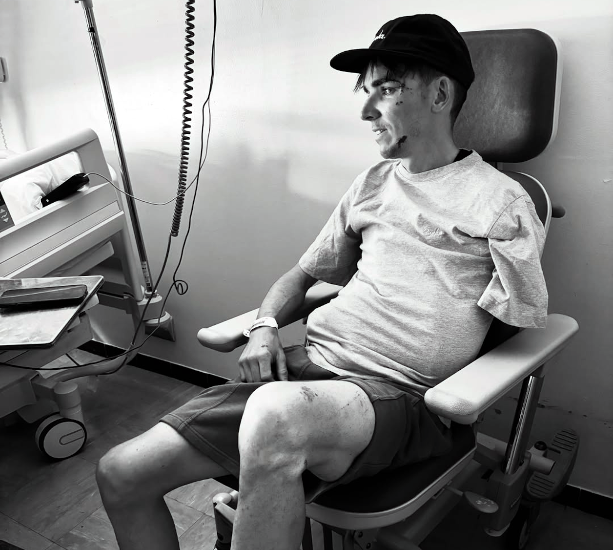 Romain Bardet’s Gravel Worlds Dreams Shattered after Brutal Mont Ventoux Crash