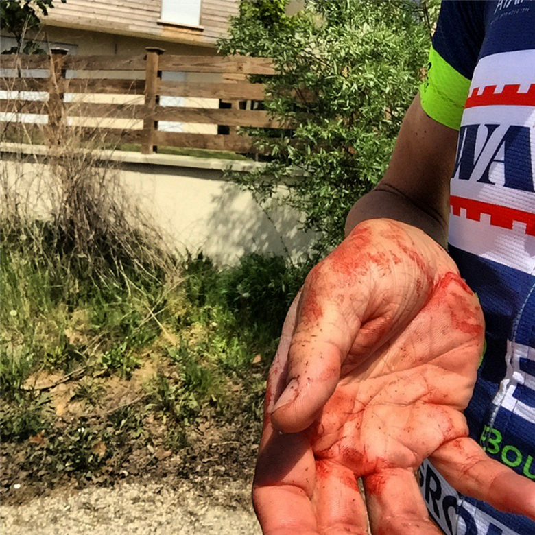 French rider Yoann Offredo left bloodied by baseball bat and knife attack