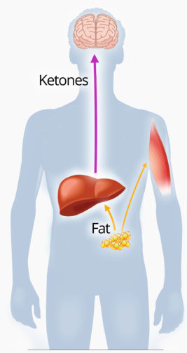What is Ketosis?