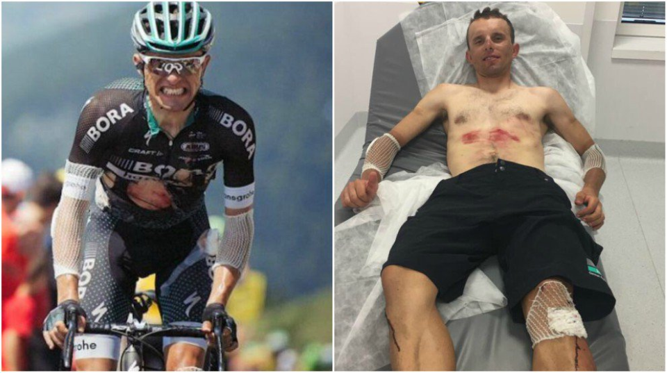Rafal Majka leaves Tour de France after heavy crash on Stage 9