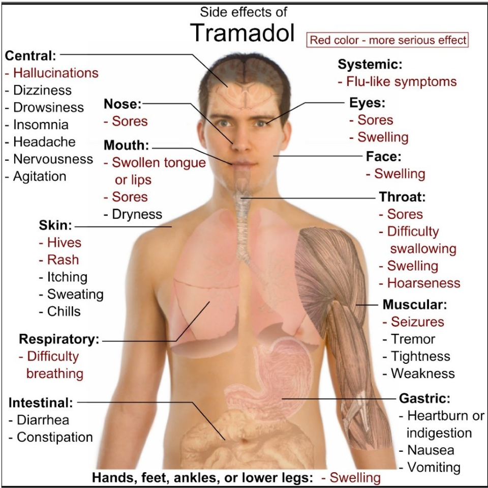 Powerful painkiller Tramadol banned from Pro Cycling